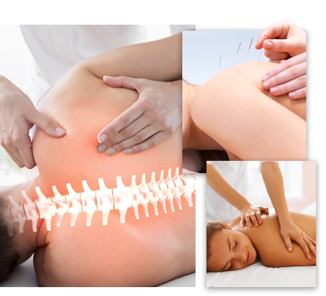 Chiropractic Toronto ON Services Photo collage of the services offered, chiropractic care, acupuncture, and massage therapy.